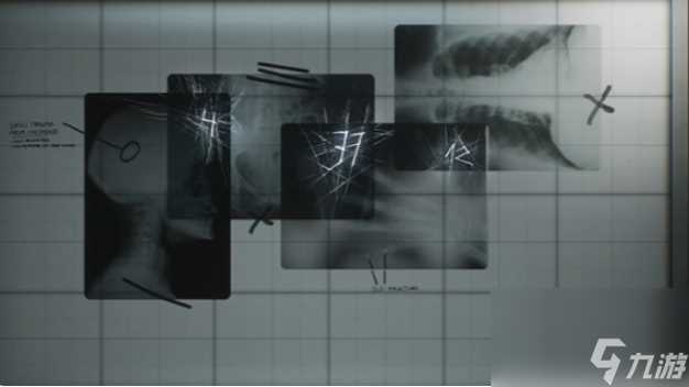 寂静岭2重制版医院密码是什么 寂静岭2重制版医院密码大全